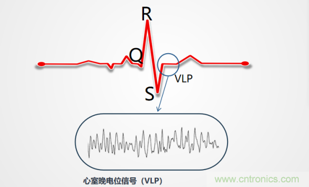 解決心電監測行業難題，曼森伯格的濾波技術獲國家知識產權局發明授權