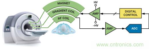 高性能數據采集係統增強數字X射線和MRI的圖像