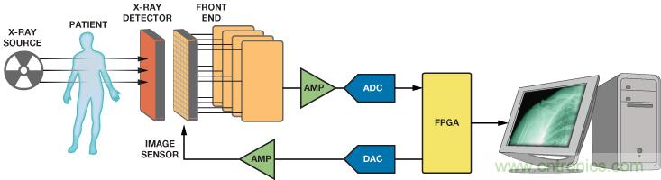 高性能數據采集係統增強數字X射線和MRI的圖像